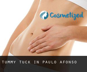 Tummy Tuck in Paulo Afonso
