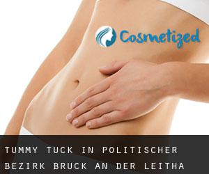 Tummy Tuck in Politischer Bezirk Bruck an der Leitha
