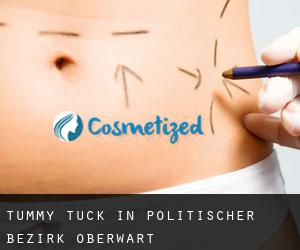 Tummy Tuck in Politischer Bezirk Oberwart