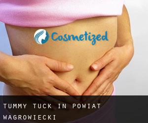 Tummy Tuck in Powiat wągrowiecki