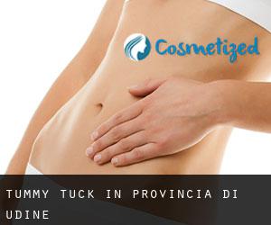 Tummy Tuck in Provincia di Udine