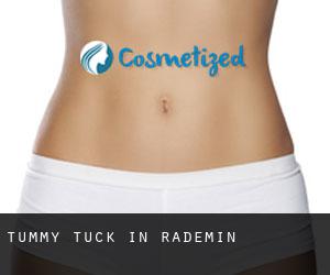 Tummy Tuck in Rademin