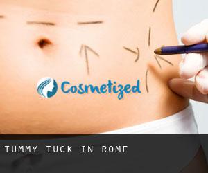Tummy Tuck in Rome