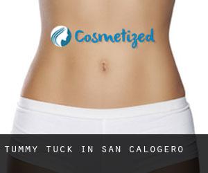Tummy Tuck in San Calogero