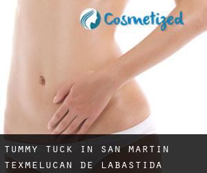 Tummy Tuck in San Martín Texmelucan de Labastida