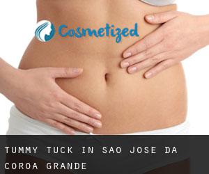Tummy Tuck in São José da Coroa Grande