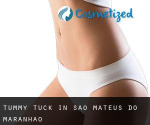Tummy Tuck in São Mateus do Maranhão