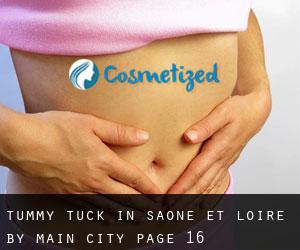 Tummy Tuck in Saône-et-Loire by main city - page 16