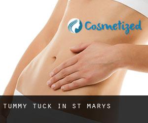 Tummy Tuck in St. Mary's