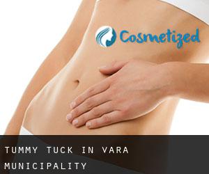Tummy Tuck in Vara Municipality