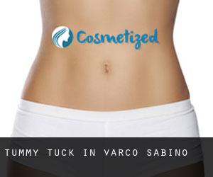 Tummy Tuck in Varco Sabino