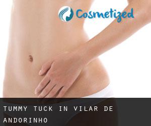 Tummy Tuck in Vilar de Andorinho