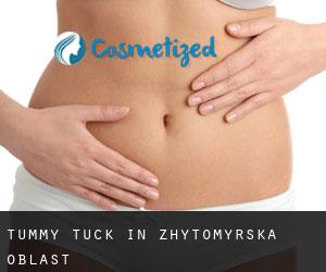 Tummy Tuck in Zhytomyrs'ka Oblast'