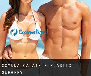 Comuna Călăţele plastic surgery
