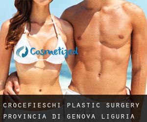 Crocefieschi plastic surgery (Provincia di Genova, Liguria)