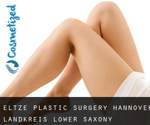 Eltze plastic surgery (Hannover Landkreis, Lower Saxony)