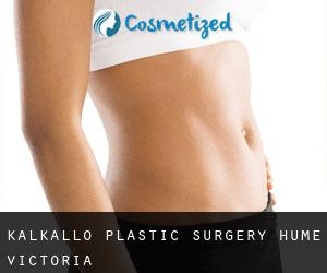 Kalkallo plastic surgery (Hume, Victoria)